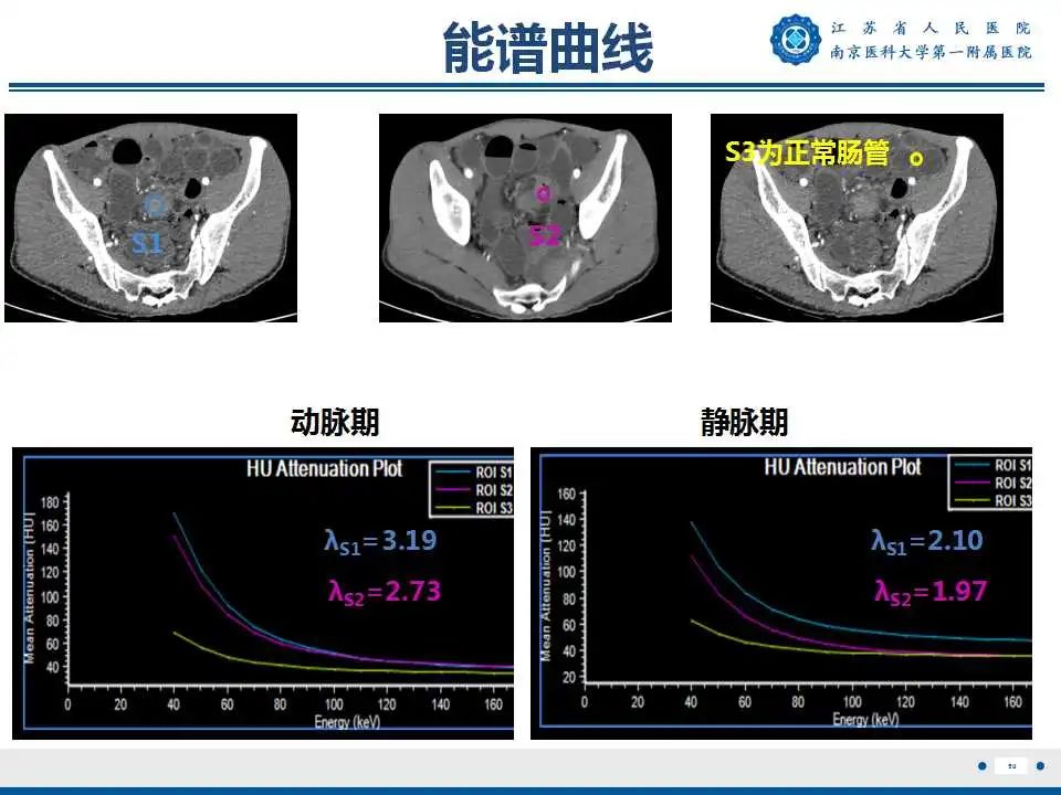 影像PPT - 【PPT】克罗恩病-51