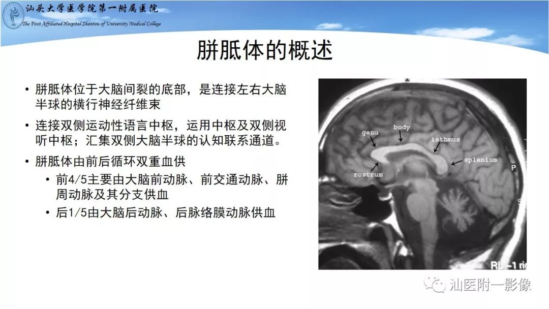 影像PPT - 【PPT】胼胝体弥散受限病变的MRI诊断思路-3