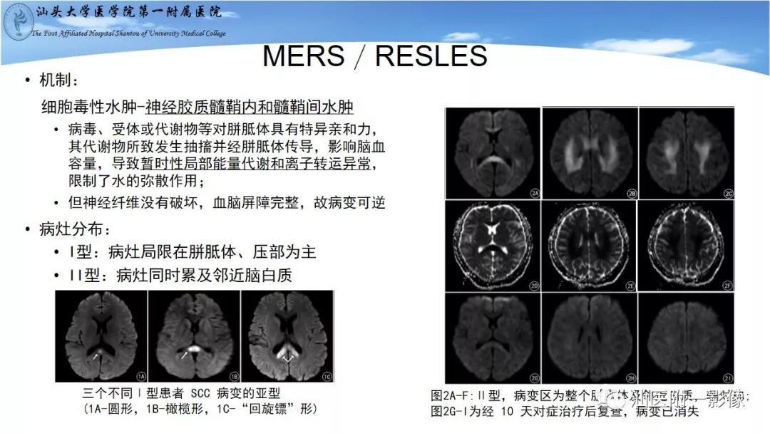 影像PPT - 【PPT】胼胝体弥散受限病变的MRI诊断思路-8
