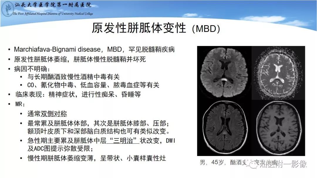 影像PPT - 【PPT】胼胝体弥散受限病变的MRI诊断思路-11