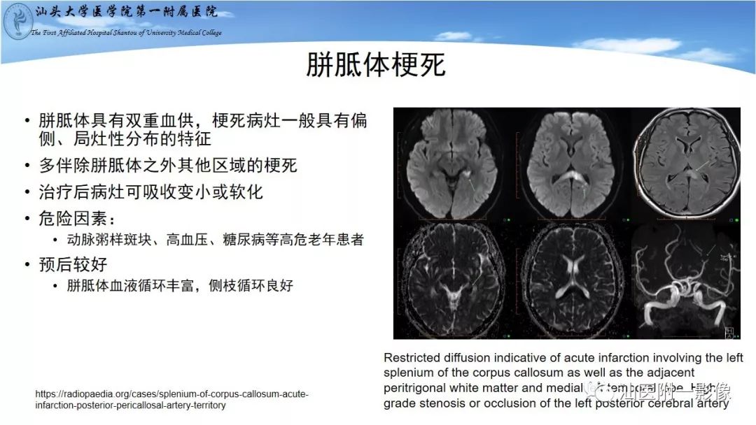 影像PPT - 【PPT】胼胝体弥散受限病变的MRI诊断思路-15