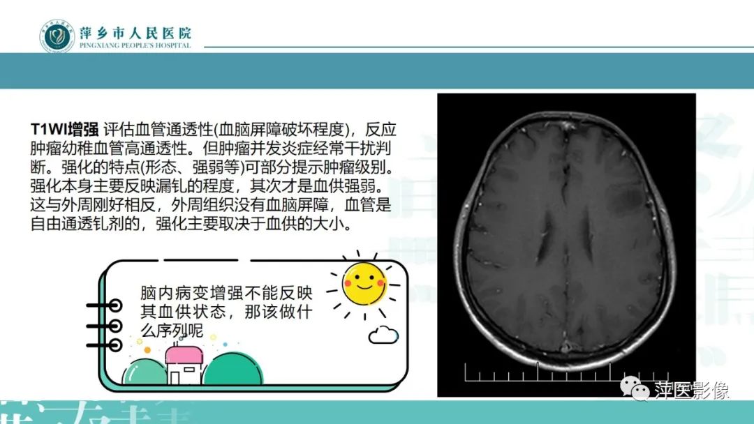 影像PPT - 【PPT】弥漫性胶质瘤MRI表现及鉴别诊断-7