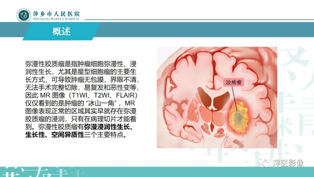 影像PPT - 【PPT】弥漫性胶质瘤MRI表现及鉴别诊断-10