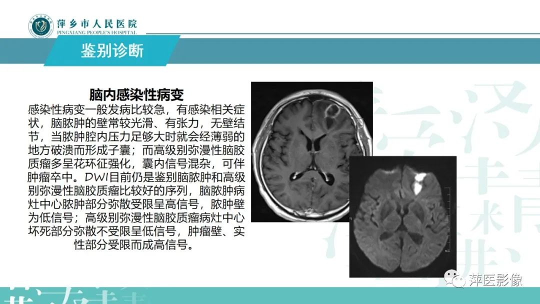 影像PPT - 【PPT】弥漫性胶质瘤MRI表现及鉴别诊断-22