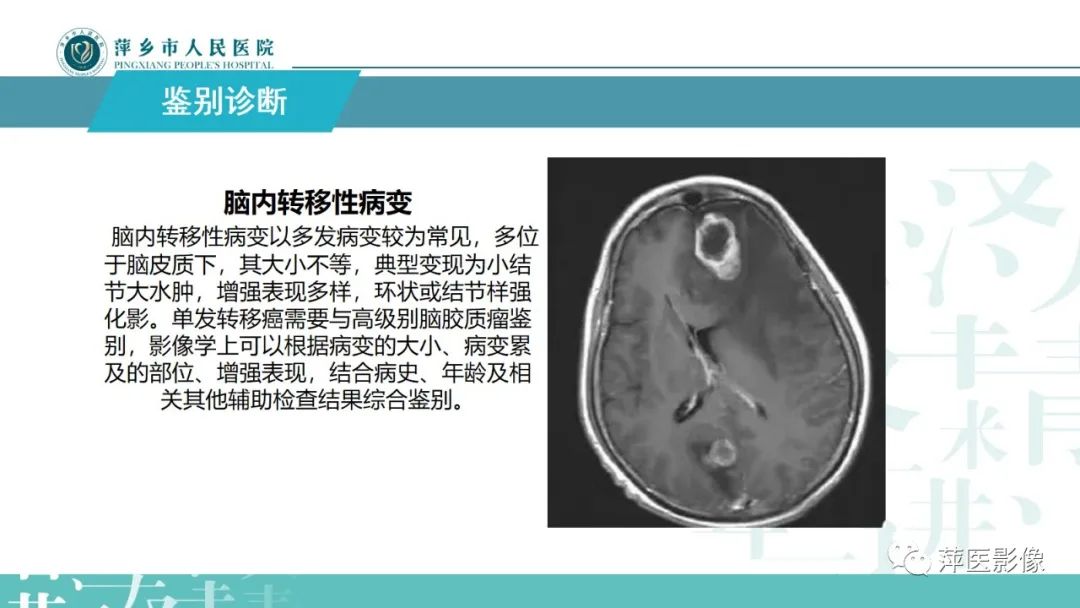 影像PPT - 【PPT】弥漫性胶质瘤MRI表现及鉴别诊断-21