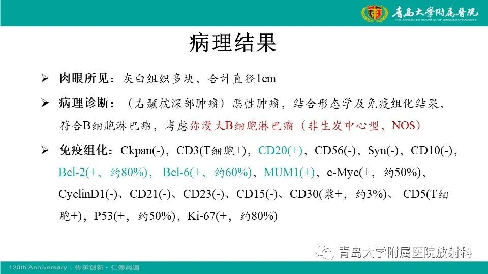 影像PPT - 【病例】原发性中枢神经系统淋巴瘤1例CT及MR影像-13