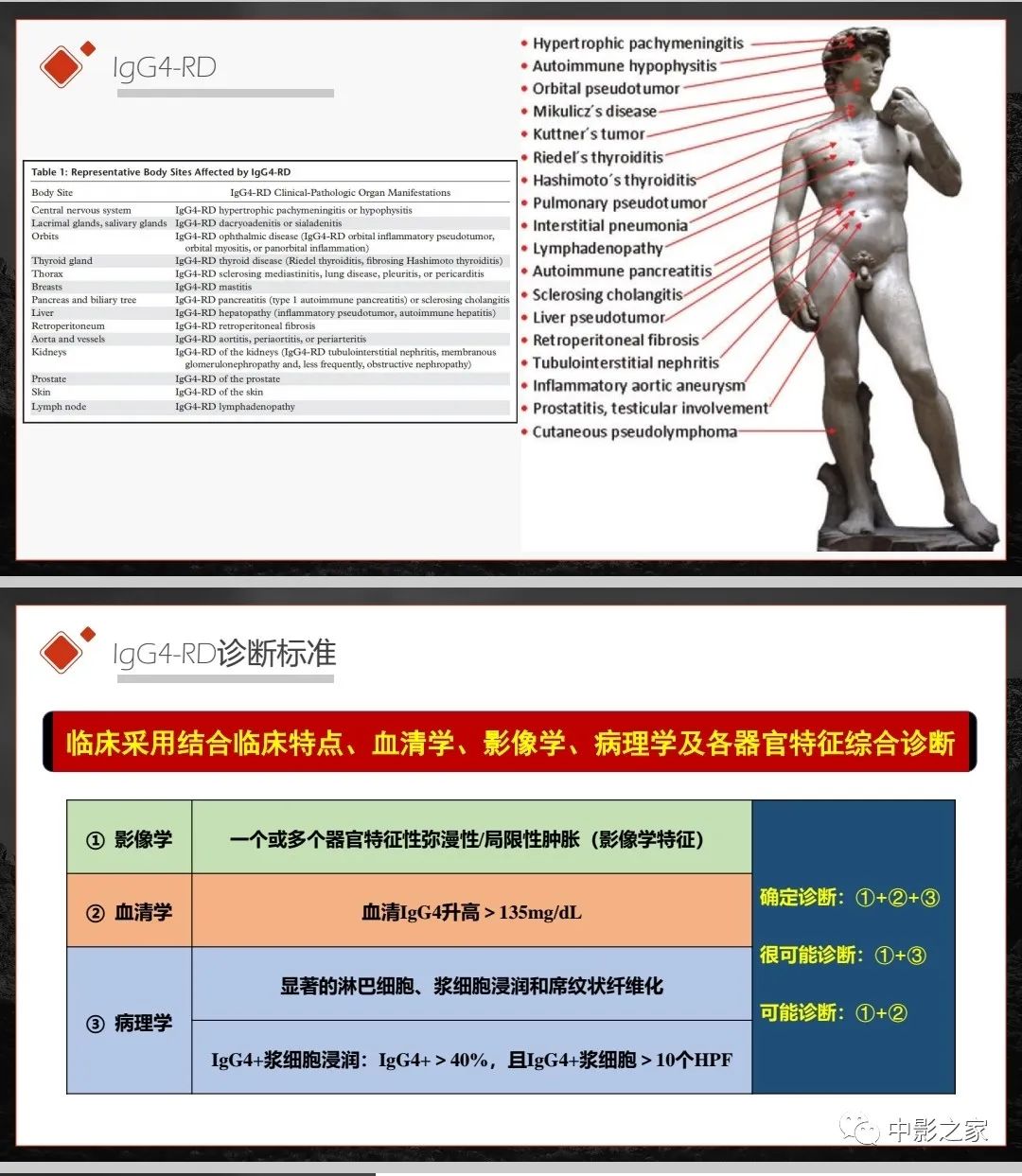 影像PPT - 【PPT】肾脏IgG4-RD临床、病理及影像特征-5