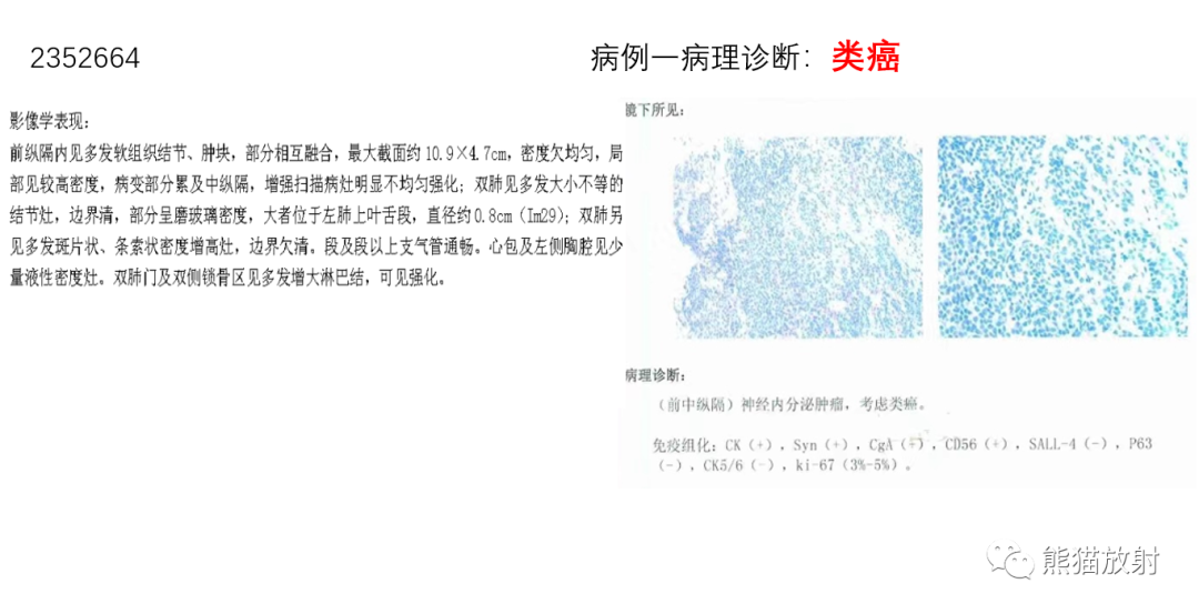影像PPT - 【病例】胸腺神经内分泌肿瘤2例CT影像-14