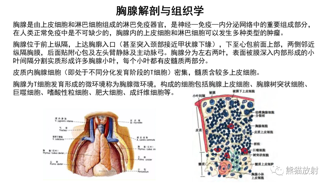 影像PPT - 【病例】胸腺神经内分泌肿瘤2例CT影像-18