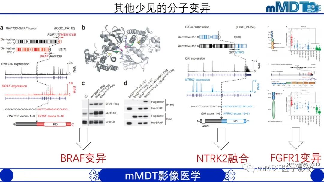 影像PPT - 【病例】脑室内毛细胞星形细胞瘤伴室管膜下转移1例MR影像-27