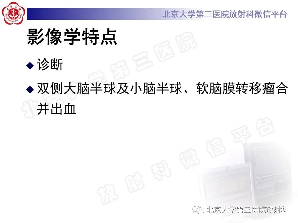 影像PPT - 【PPT】脑膜转移瘤-8