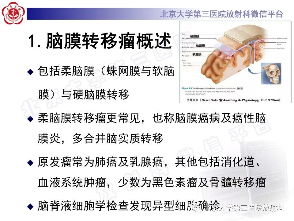 影像PPT - 【PPT】脑膜转移瘤-10