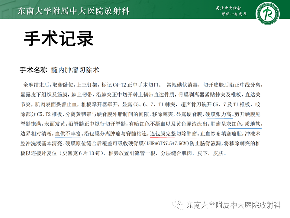影像PPT - 【PPT】脊髓室管膜瘤-7 影像PPT - 【PPT】脊髓室管膜瘤-7