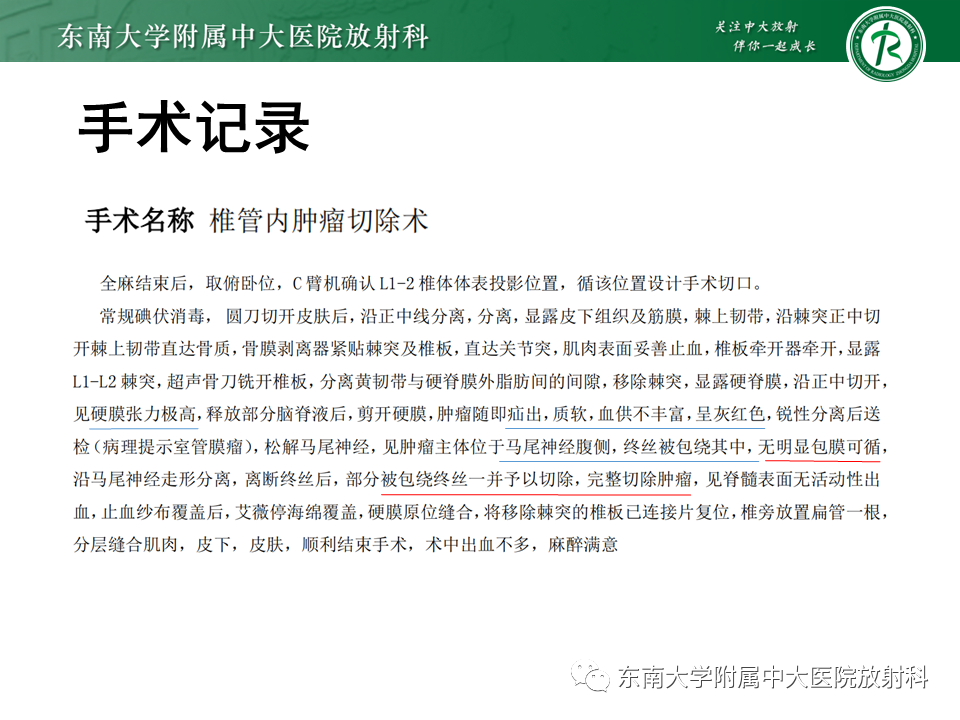 影像PPT - 【PPT】脊髓室管膜瘤-11 影像PPT - 【PPT】脊髓室管膜瘤-11