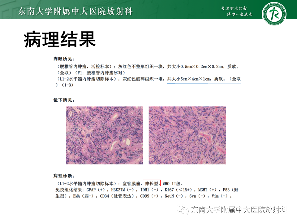 影像PPT - 【PPT】脊髓室管膜瘤-12 影像PPT - 【PPT】脊髓室管膜瘤-12