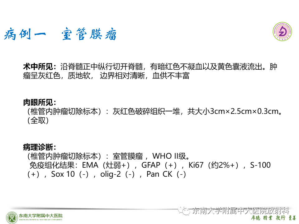 影像PPT - 【PPT】脊髓室管膜瘤-20 影像PPT - 【PPT】脊髓室管膜瘤-20