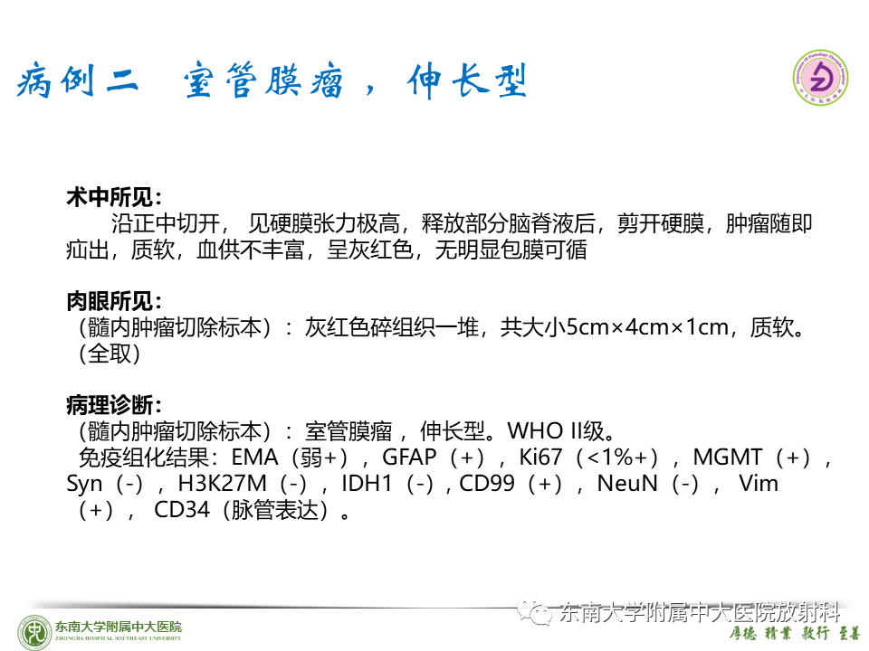 影像PPT - 【PPT】脊髓室管膜瘤-27 影像PPT - 【PPT】脊髓室管膜瘤-27