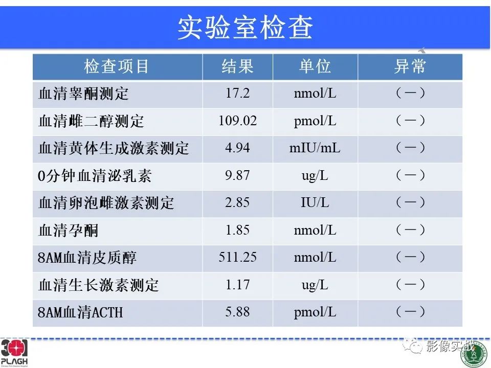 影像PPT - 【病例】鞍区孤立性纤维瘤1例CT及MR影像-4