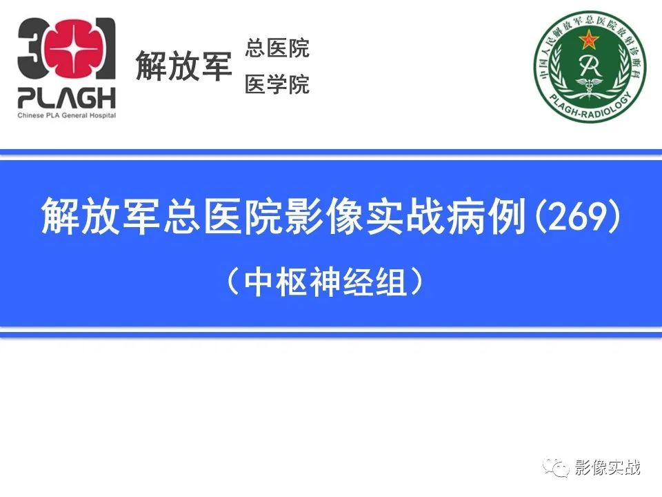 影像PPT - 【病例】鞍区孤立性纤维瘤1例CT及MR影像-1