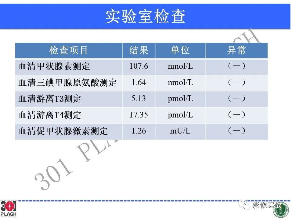 影像PPT - 【病例】鞍区孤立性纤维瘤1例CT及MR影像-3