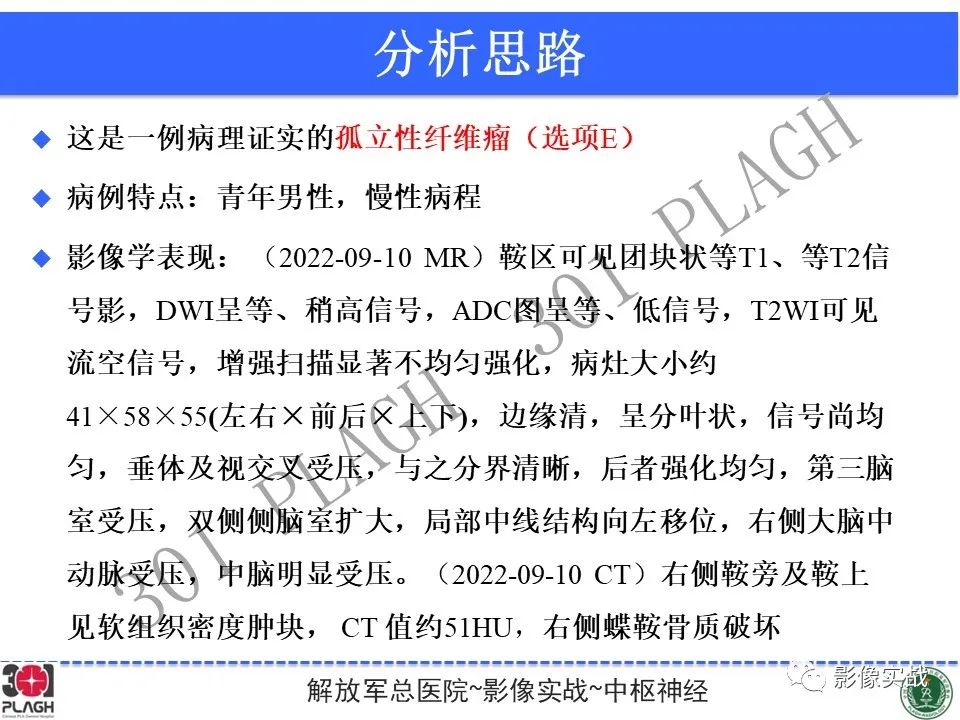 影像PPT - 【病例】鞍区孤立性纤维瘤1例CT及MR影像-17