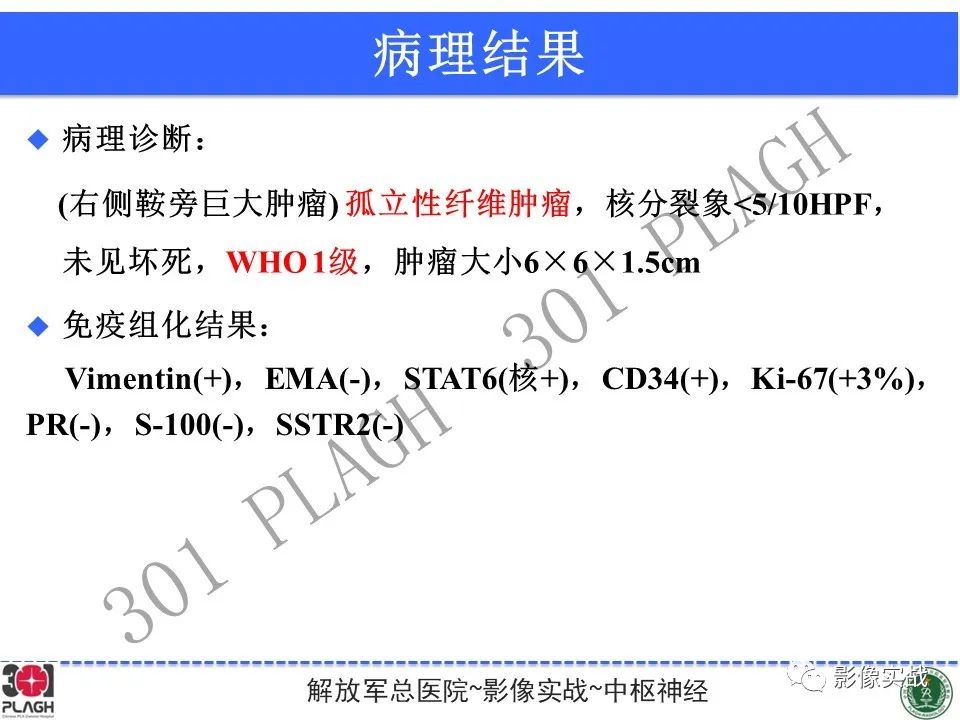影像PPT - 【病例】鞍区孤立性纤维瘤1例CT及MR影像-23