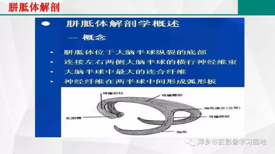 影像PPT - 【PPT】可逆性胼胝体压部病变综合征-6