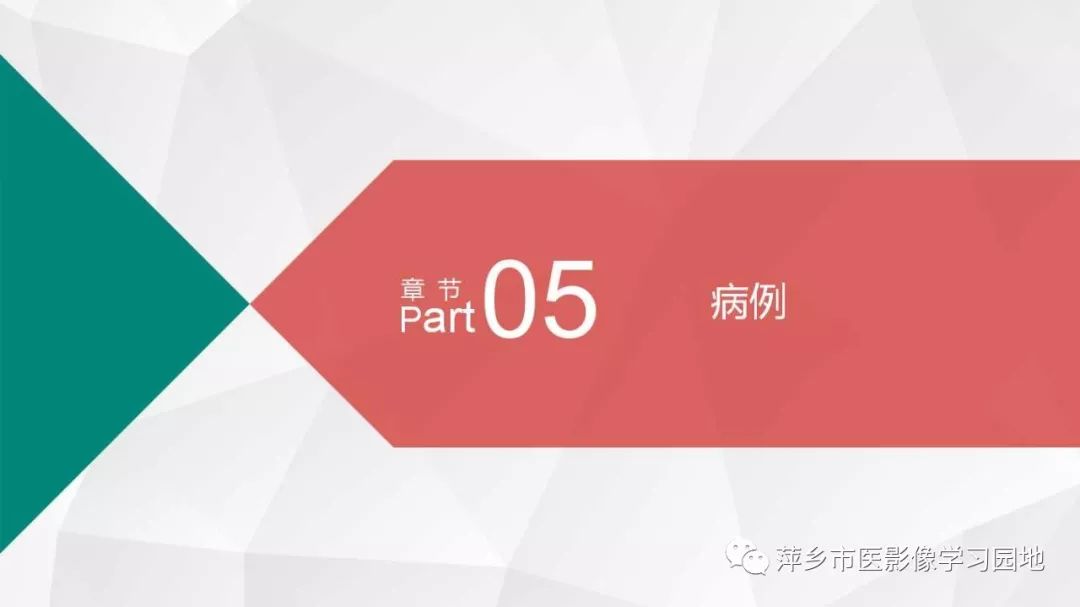 影像PPT - 【PPT】可逆性胼胝体压部病变综合征-18