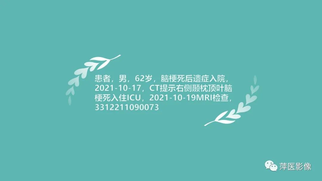 影像PPT - 【PPT】脑皮质层状坏死的影像诊断-4