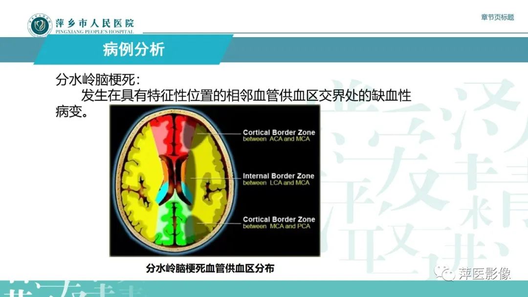 影像PPT - 【PPT】脑皮质层状坏死的影像诊断-8