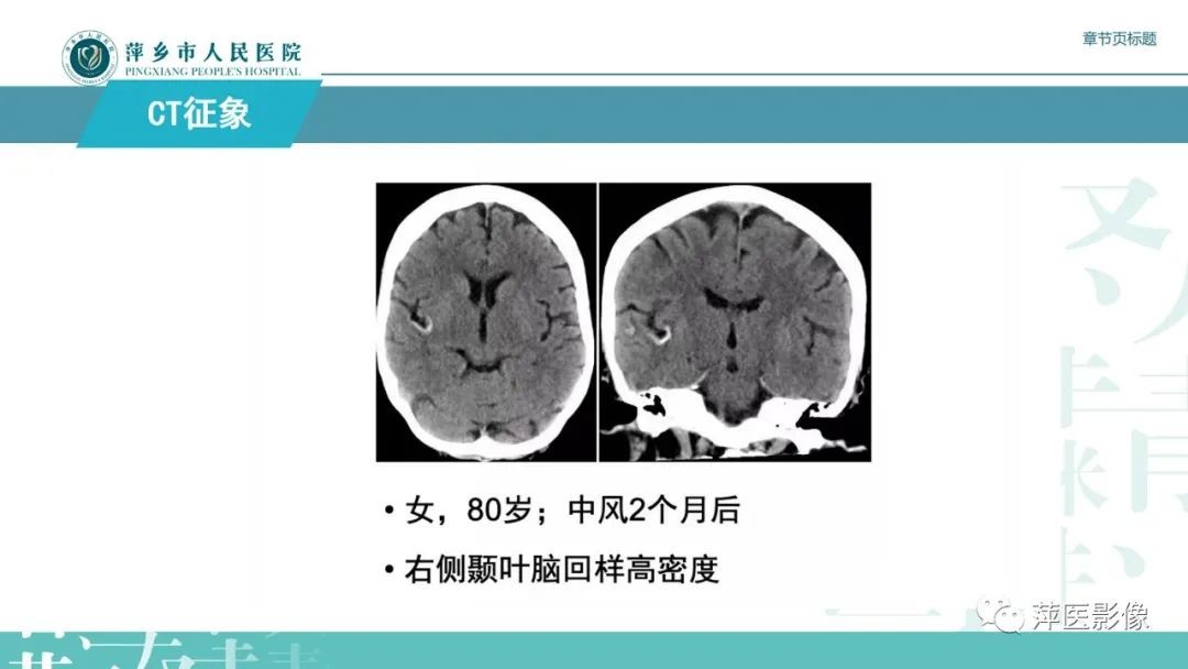 影像PPT - 【PPT】脑皮质层状坏死的影像诊断-17