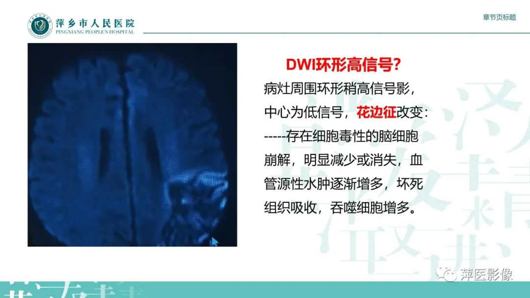 影像PPT - 【PPT】脑皮质层状坏死的影像诊断-23