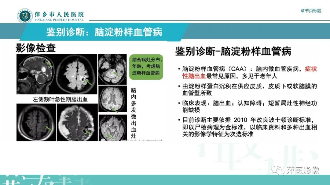 影像PPT - 【PPT】脑皮质层状坏死的影像诊断-30