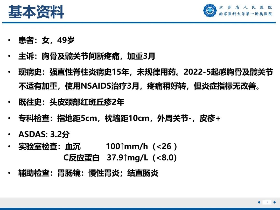 影像PPT - 【PPT】强直性脊柱炎-2