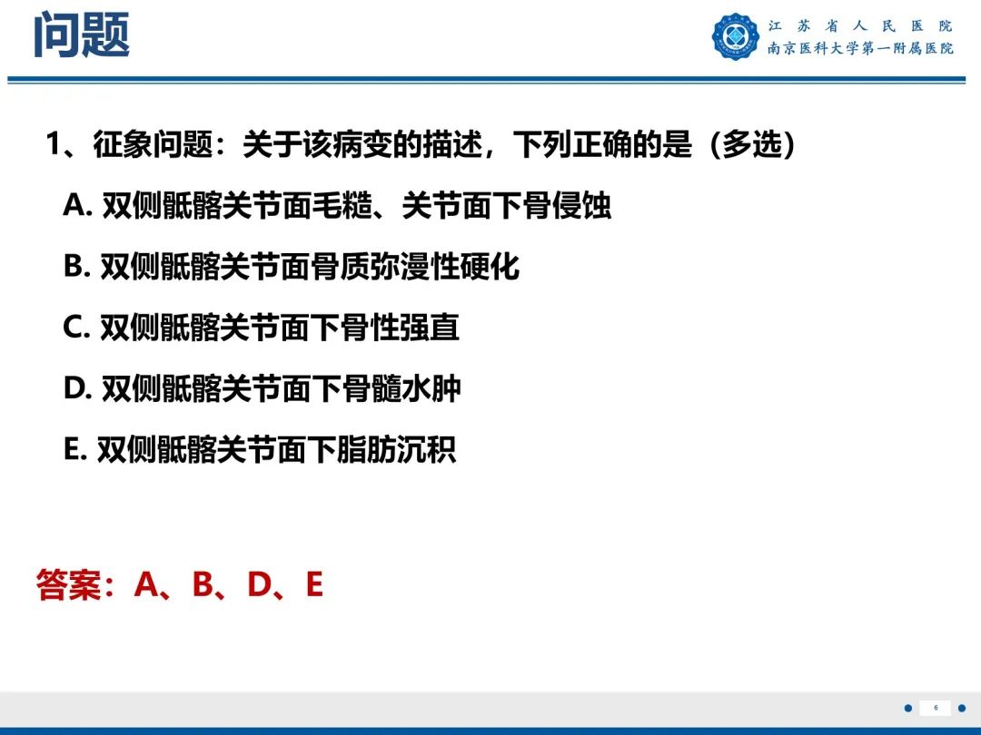影像PPT - 【PPT】强直性脊柱炎-7