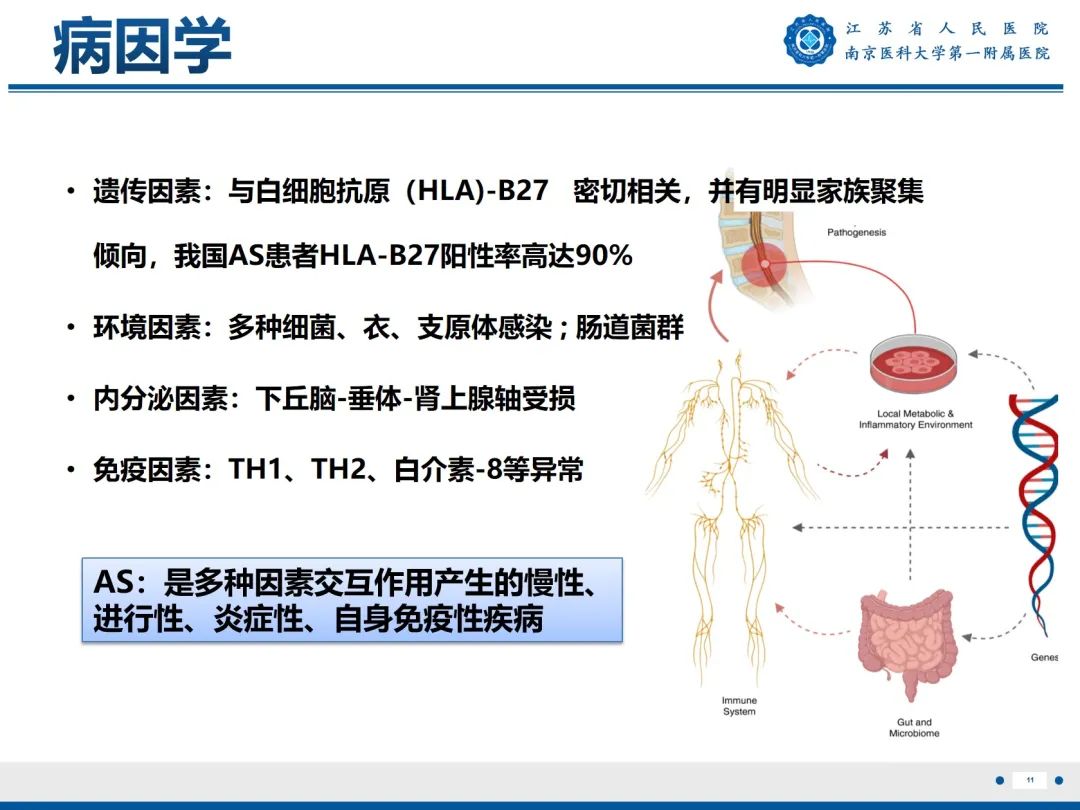 影像PPT - 【PPT】强直性脊柱炎-12