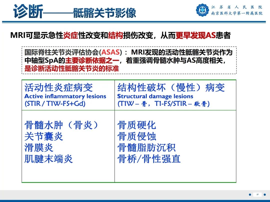 影像PPT - 【PPT】强直性脊柱炎-28