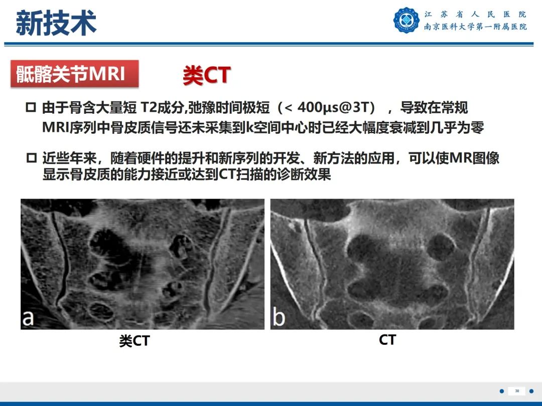 影像PPT - 【PPT】强直性脊柱炎-31