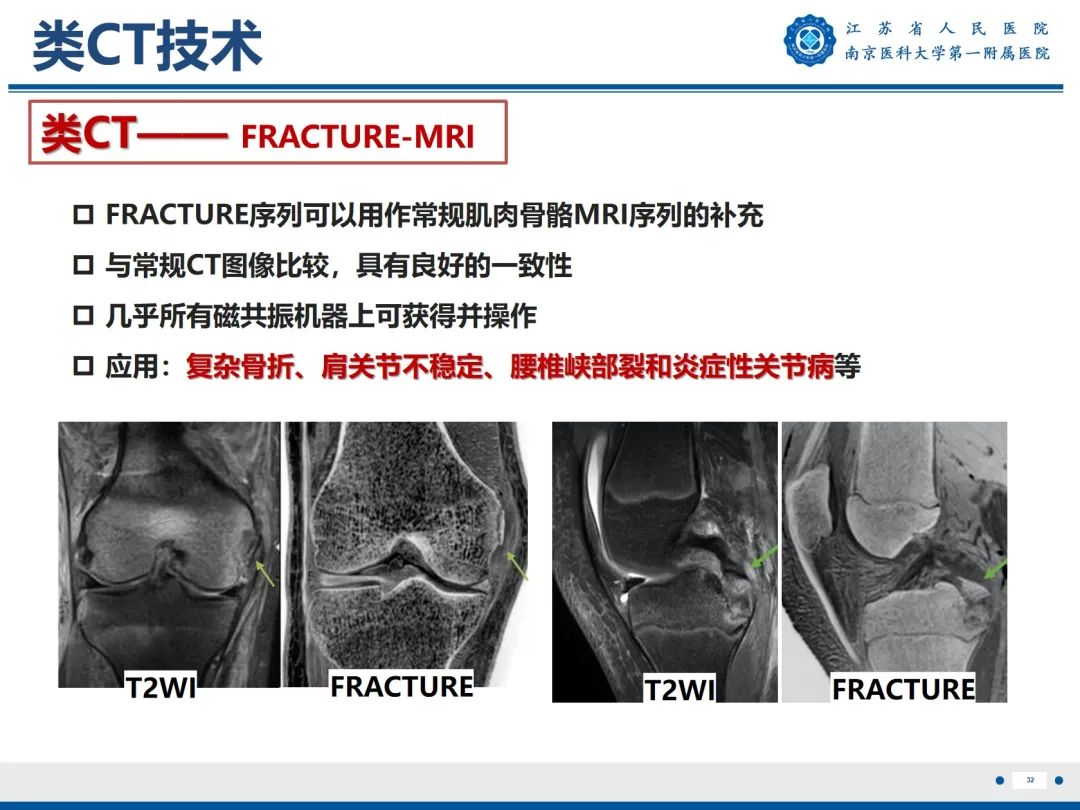 影像PPT - 【PPT】强直性脊柱炎-33