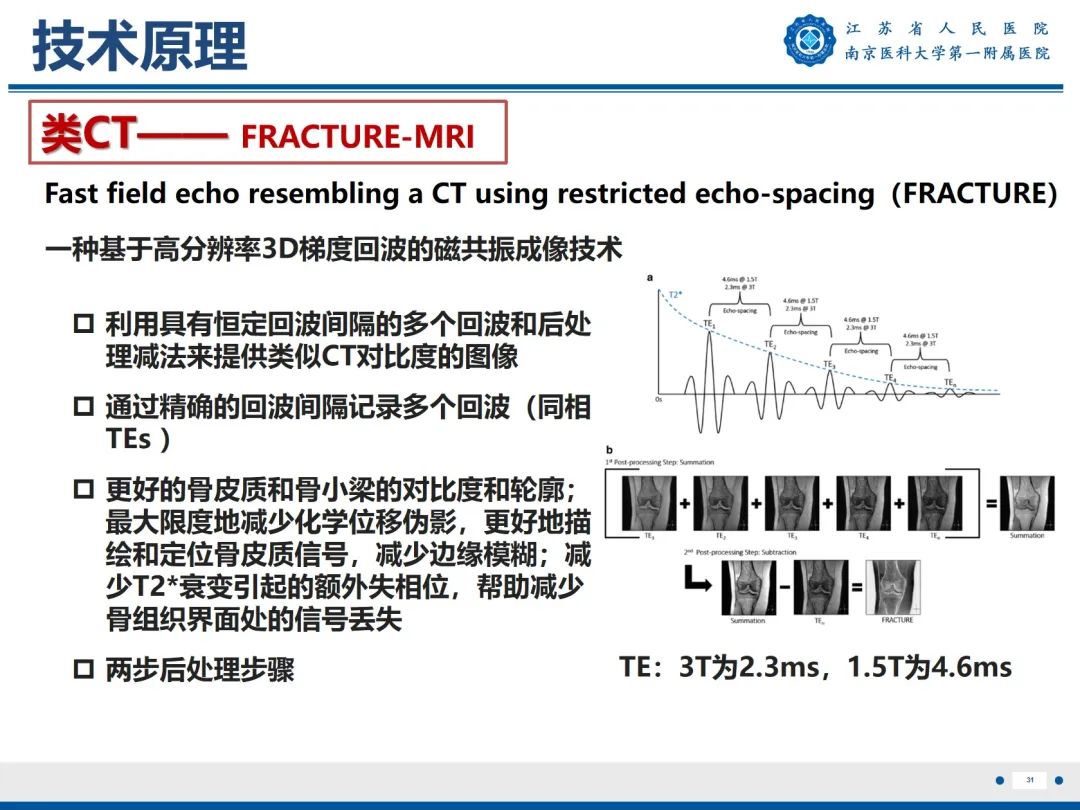 影像PPT - 【PPT】强直性脊柱炎-32