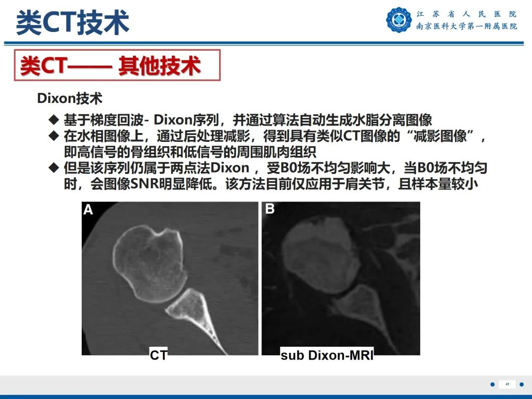 影像PPT - 【PPT】强直性脊柱炎-42