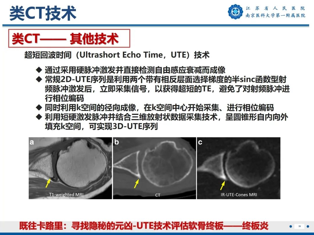 影像PPT - 【PPT】强直性脊柱炎-40