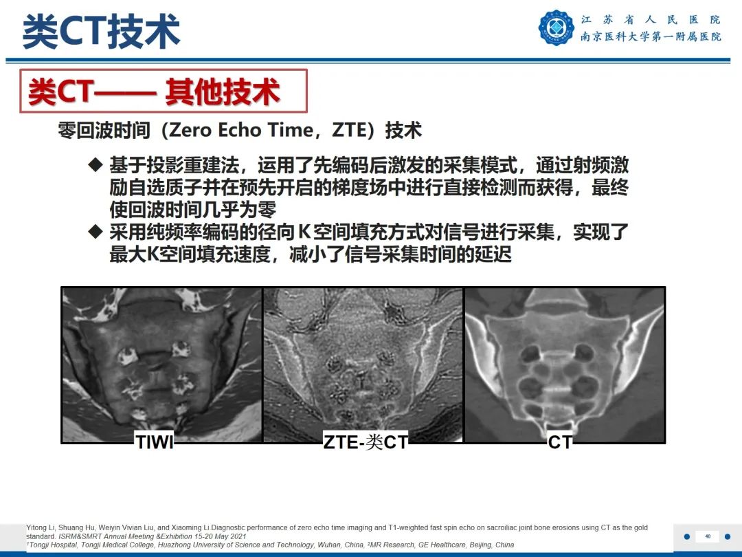 影像PPT - 【PPT】强直性脊柱炎-41