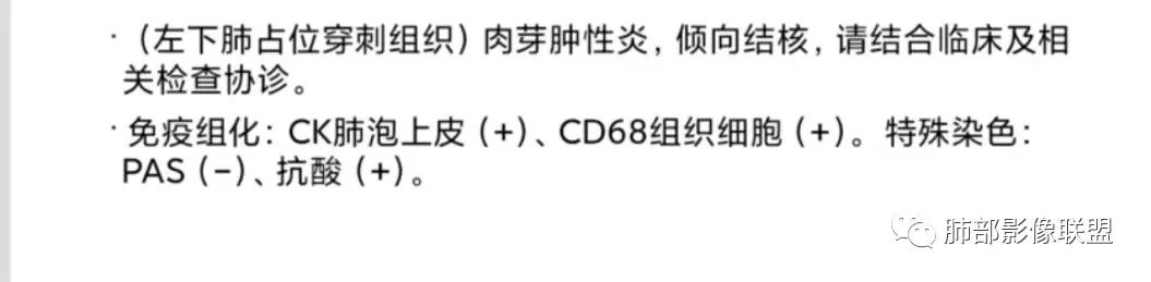 影像PPT - 【病例】HIV背景下的肺结节-38 影像PPT - 【病例】HIV背景下的肺结节-38