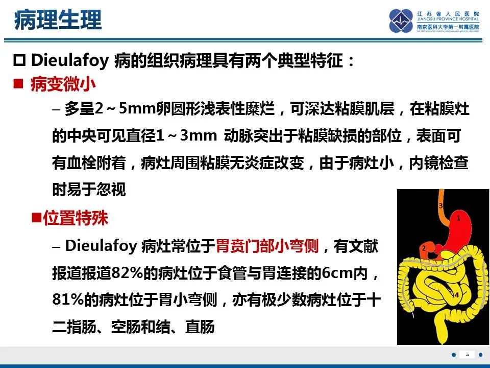 影像PPT - 【PPT】胃恒径动脉综合征-24
