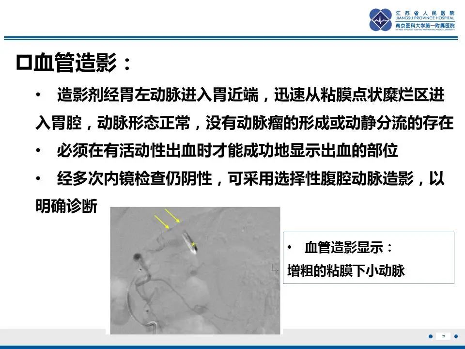 影像PPT - 【PPT】胃恒径动脉综合征-28