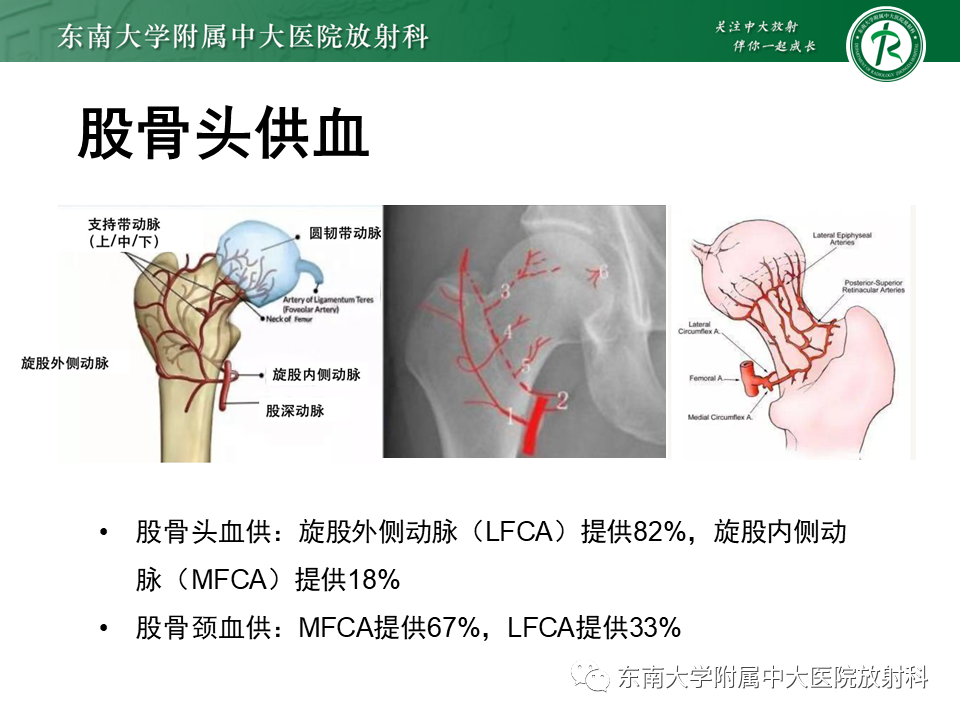 影像PPT - 【PPT】成人非外伤性股骨头缺血性坏死-6