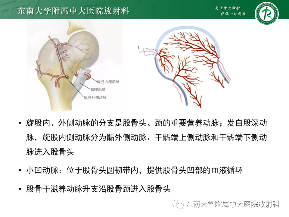 影像PPT - 【PPT】成人非外伤性股骨头缺血性坏死-7