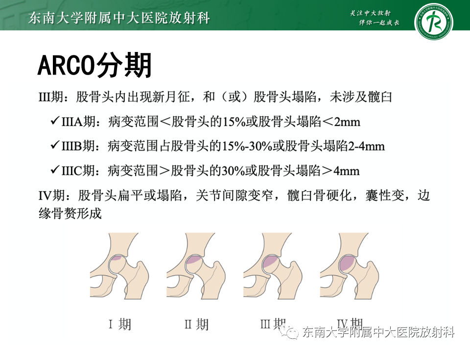 影像PPT - 【PPT】成人非外伤性股骨头缺血性坏死-13