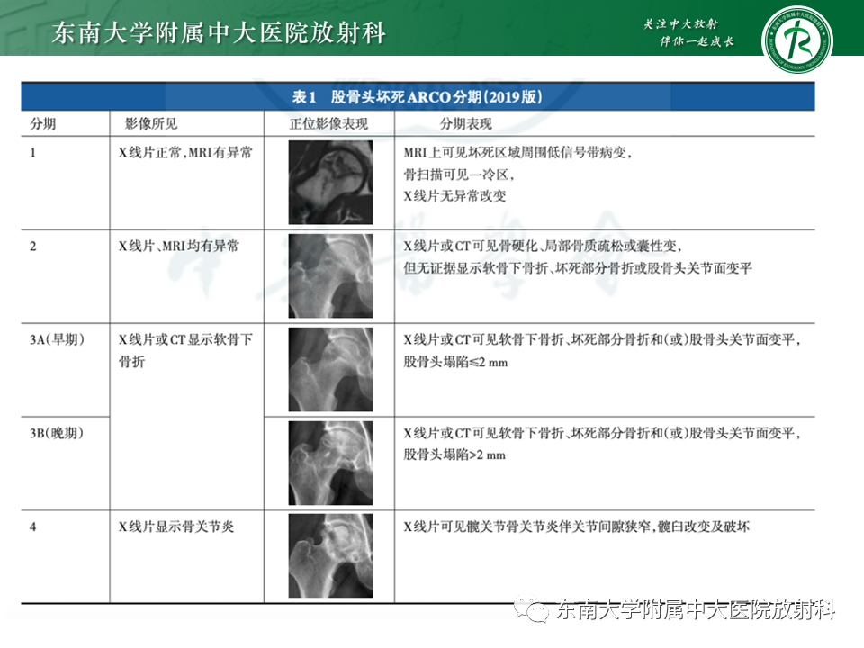 影像PPT - 【PPT】成人非外伤性股骨头缺血性坏死-14